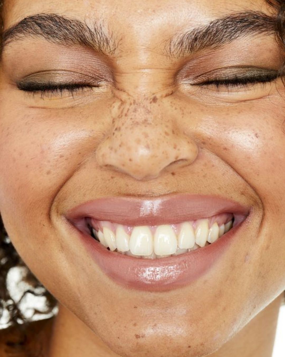 It's sunny: beware of hyperpigmentation A few tips on how to prevent and minimize dark spots