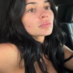 Spot treatment: guide on how to treat pimples All products that can help reduce inflammation faster