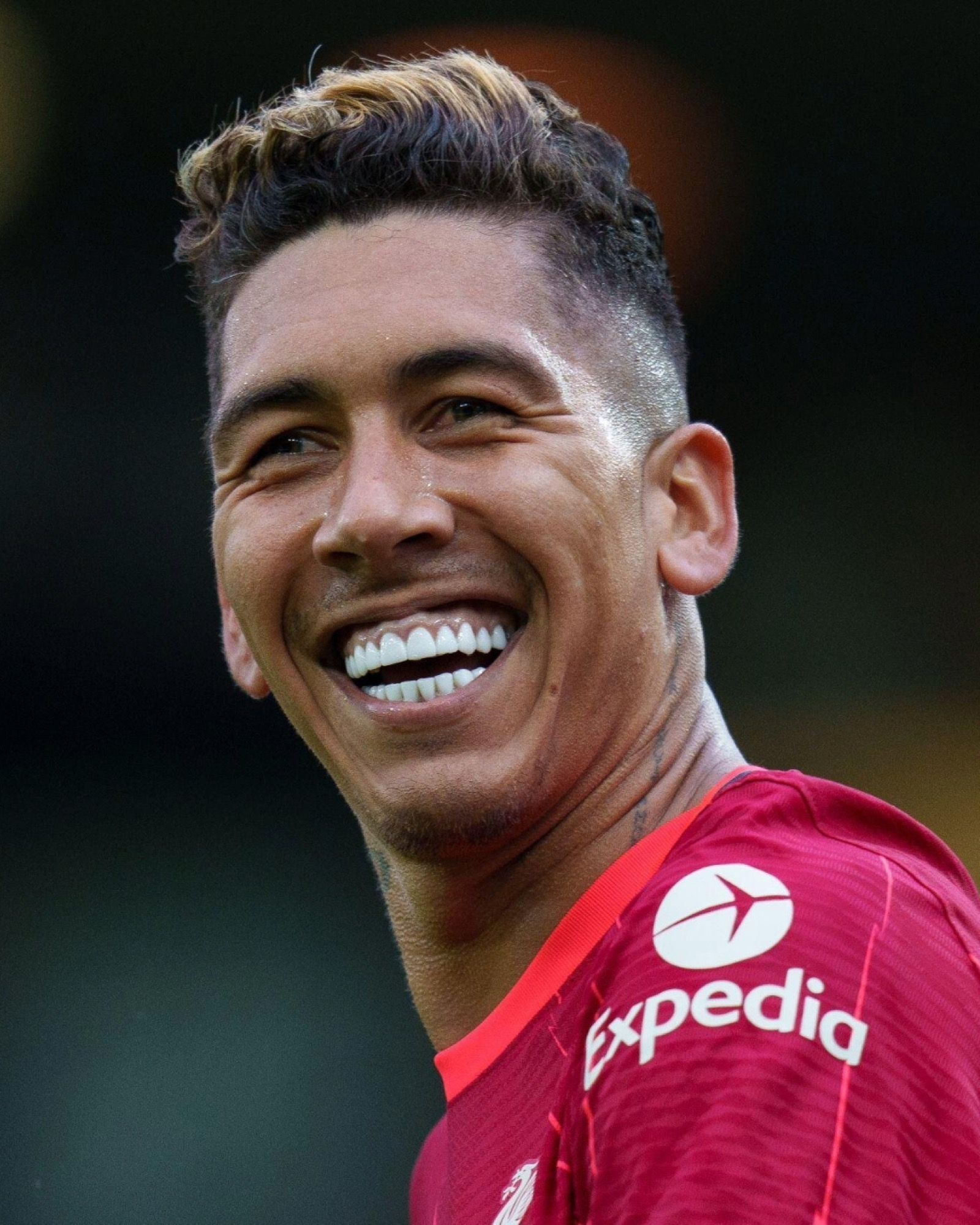 Footballers&apos; teeth are whiter and whiter Veneers are a trend among players and coaches