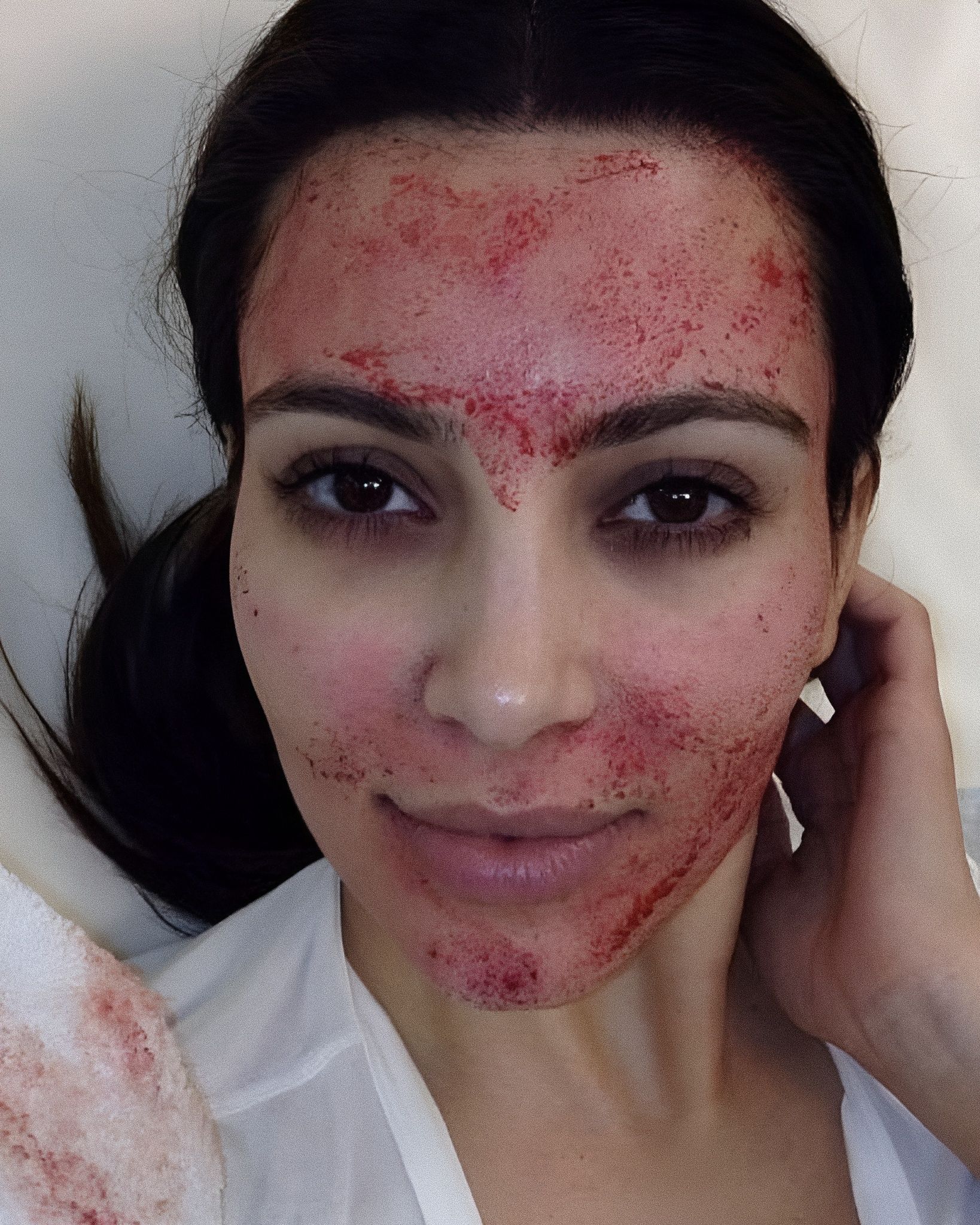 Microneedling, what is it and does it really work? All you need to know about the treatment loved by celebrities and more