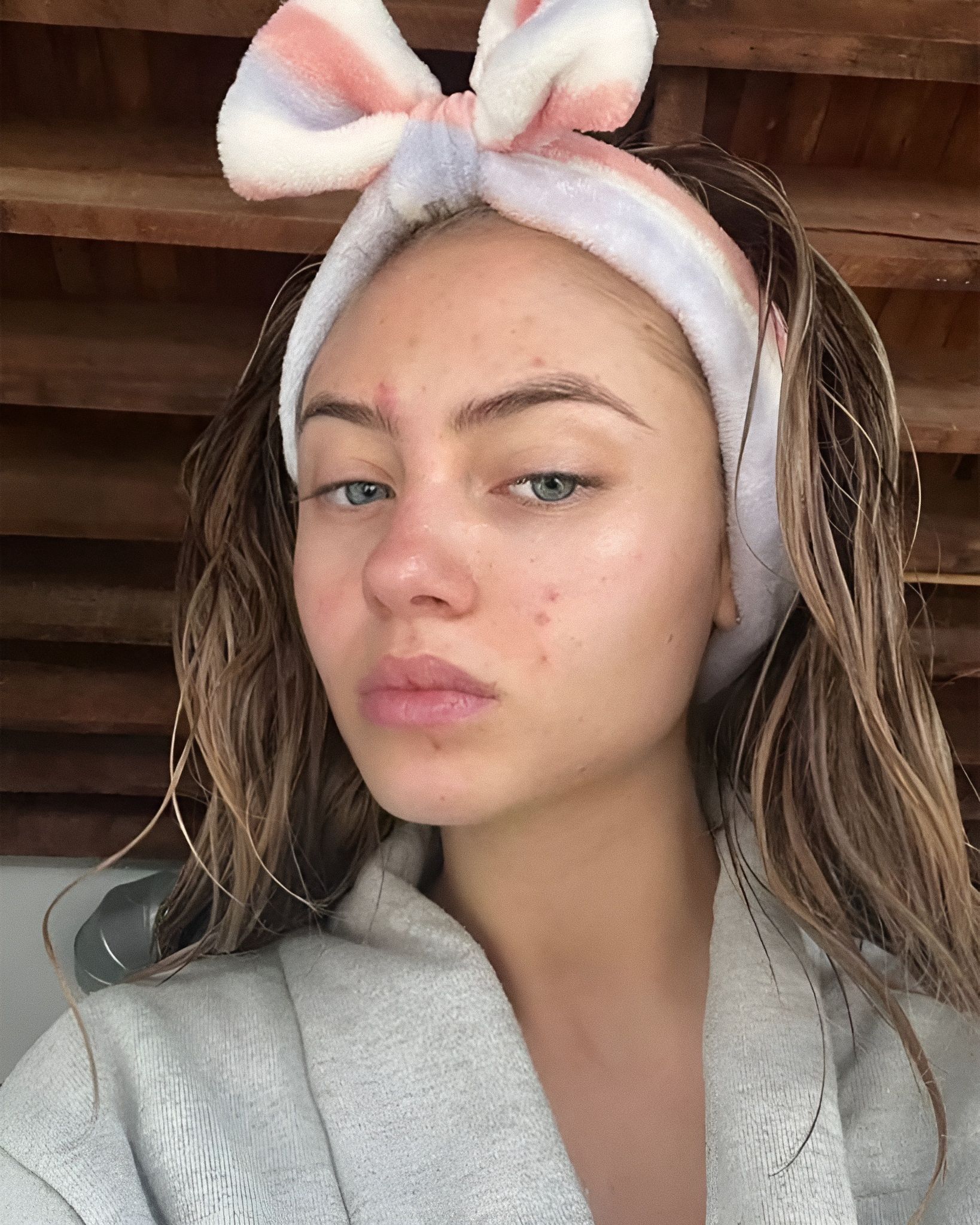 Let&apos;s talk about skin purging: what is it and why does it happen? How to tell if it&apos;s irritation or just cell turnover