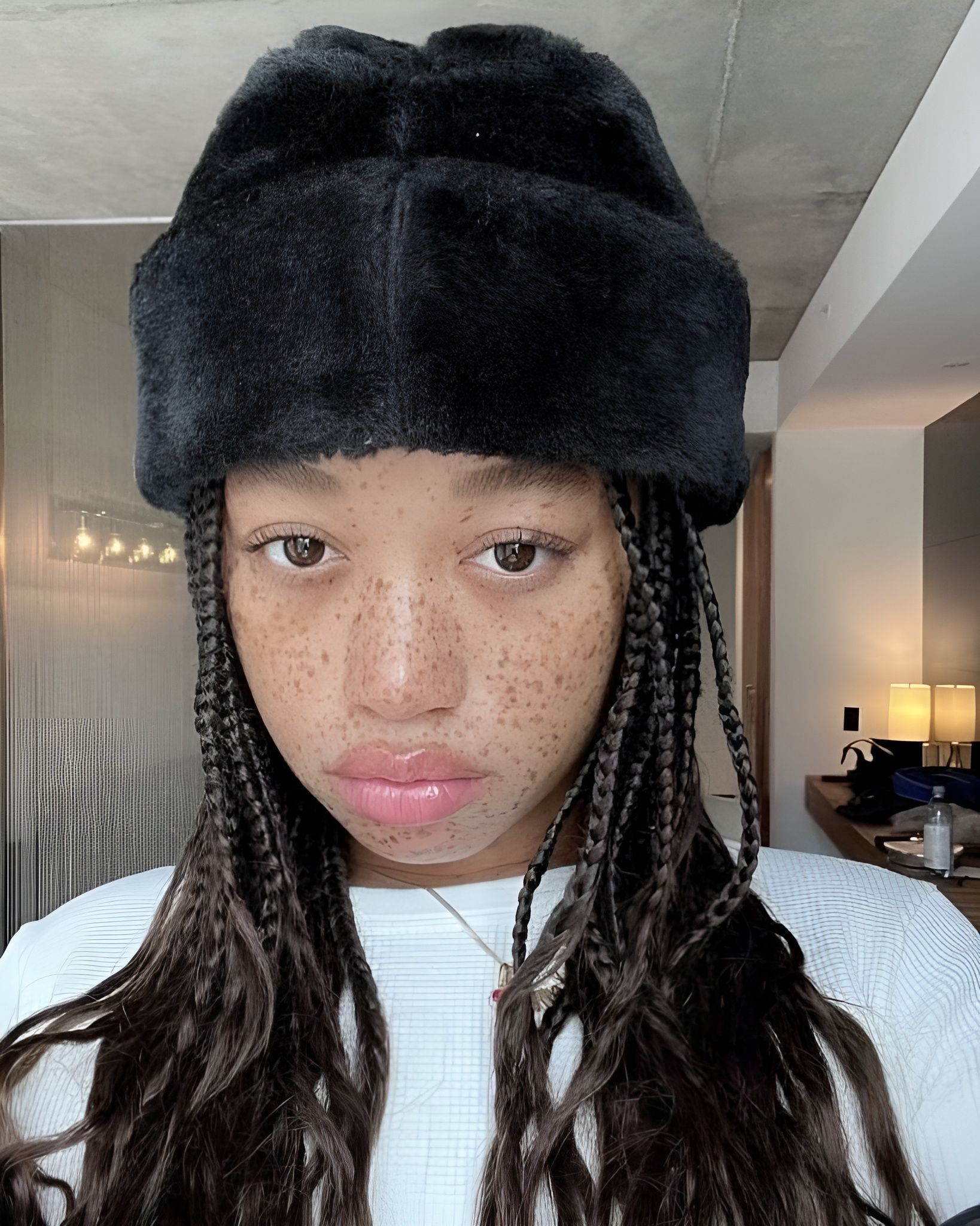 Tutto sul volufiline, il presunto siero effetto filler Ci crediamo?