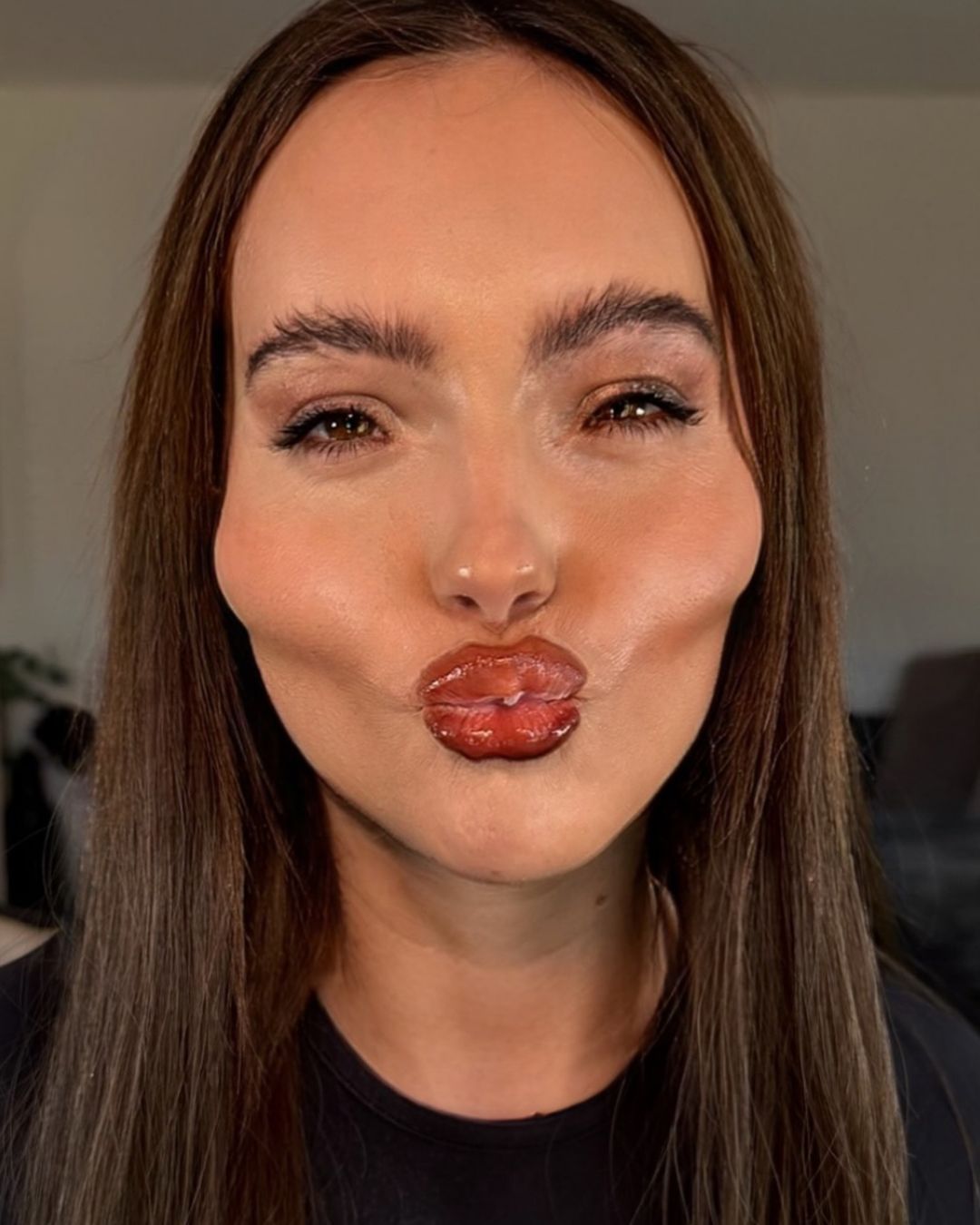 We have transformed aesthetic failure into a genre of entertainment From reality TV to videos on TikTok, cosmetic surgery interests us especially when it goes wrong