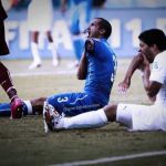 Mordili ancora, Luis Le piu' esilaranti immagini del morso di Suarez